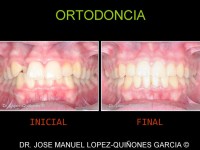 096-ortodoncia